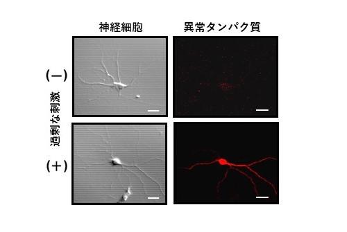 過剰な神経刺激により、ADに関わる異常 タンパク質が現れる